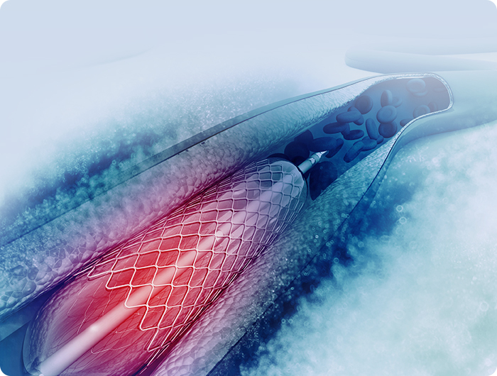 99草草国产熟女视频在线