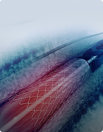 99草草国产熟女视频在线